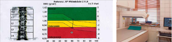 Knochendichtemessung